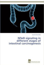NF-kB signaling in different stages of intestinal carcinogenesis
