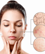 Interview Generation Pille