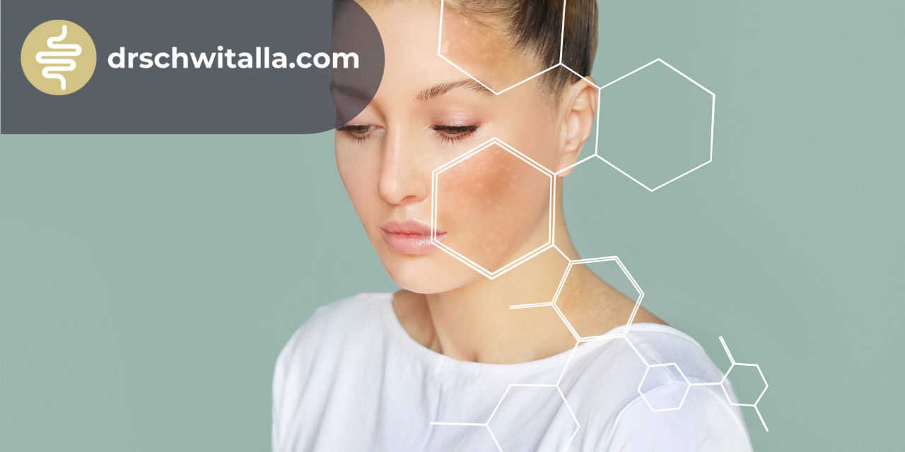 Neurodermitis Darm Schwitalla